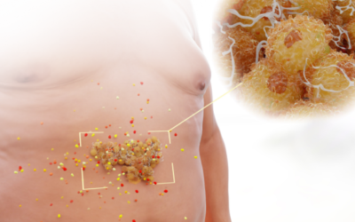 Visceral Fat: A Marker for Systemic Inflammation